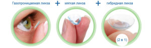 Газопроницаемая линза мягкая линза