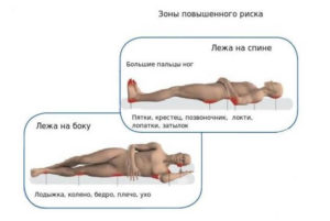 Как пользоваться