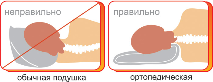 правильная подушка